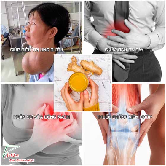 Một số loại thuốc được chế biến từ tinh bột nghệ